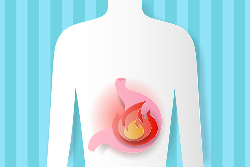 Hàm lượng acid tăng cao gây ra những kích thích khiến người bệnh có cảm giác nóng rát trong bụng 